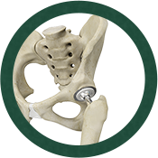 Hip Replacement Icon